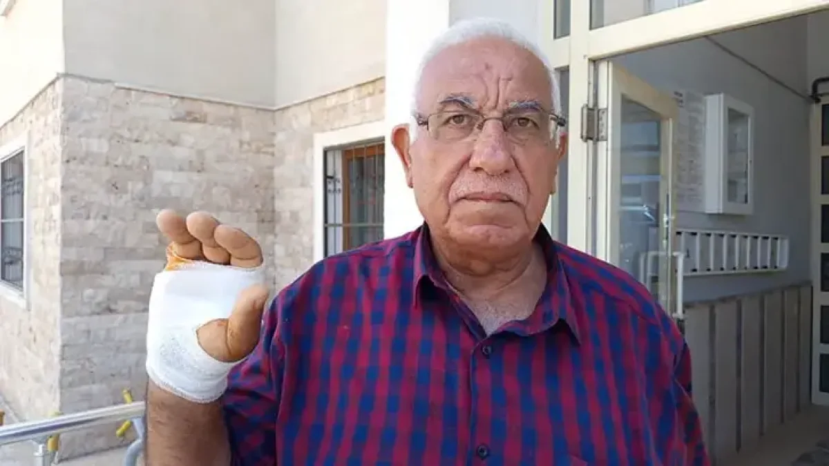Komşusunun Isırdığı Parmağı Ampute Edildi